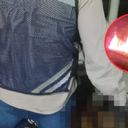 Hombre prende fuego a persona en situación de calle en Ciudad Madero; este es su estado de salud
