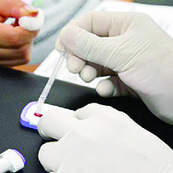 Refuerzan la detección de enfermedades VIH, hepatitis C y sífilis; aplican casi 6 mil pruebas