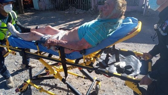Abuelito resulta quemado y se queda sin casa por incendio