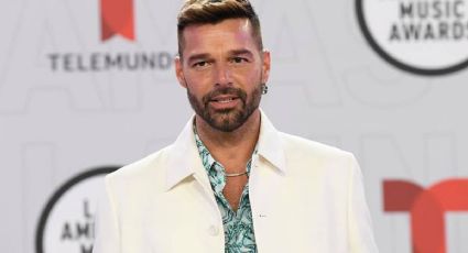 Esto fue lo que le pasó al rostro de Ricky Martin, aclaran en comunicado