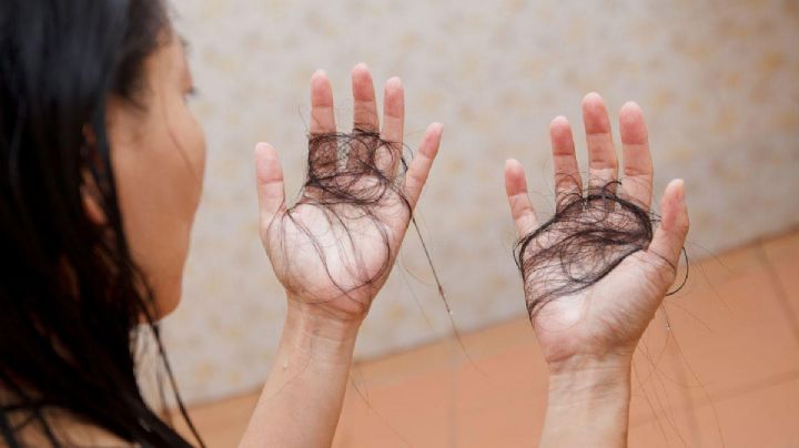 ¿Se te cae el cabello después de tener Covid? Esto puedes hacer