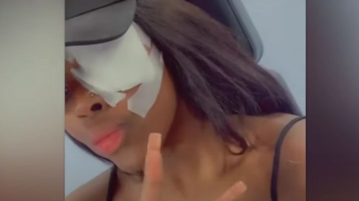 VIDEO VIRAL: Cargador de celular explota y le quema el ojo a una joven