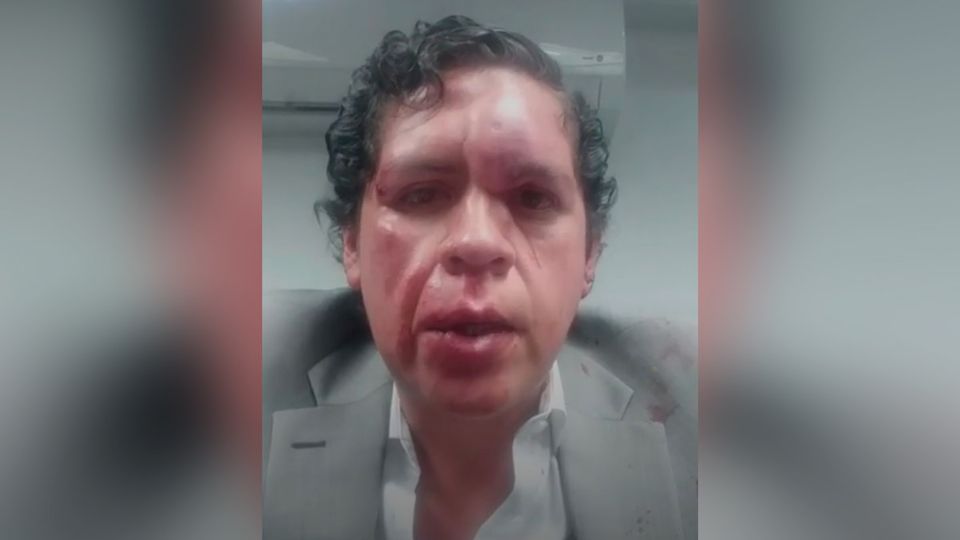 Álvaro Morales fue brutalmente golpeado