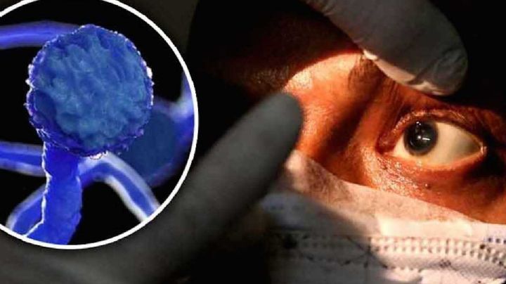 ¡Cuidado! Así entra el hongo negro a tu organismo