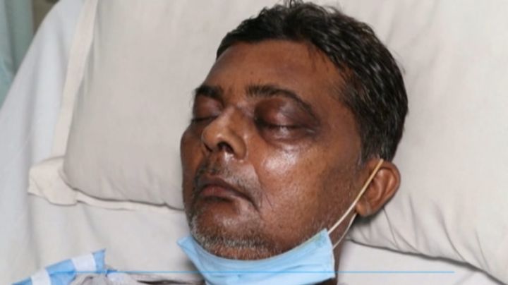 ¿Dónde vive el hongo negro y cuándo es mortal?