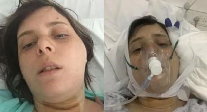 Mujer se dislocó la mandíbula al morder una hamburguesa triple carne