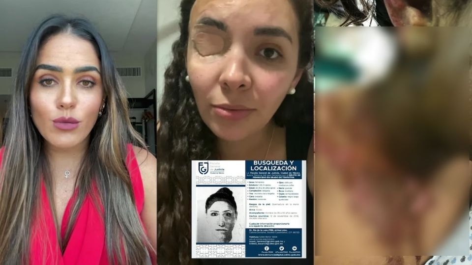 La mujer le arrojó ácido en su cara