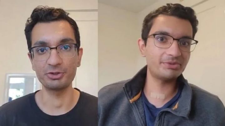 Tiktoker descubre rara enfermedad gracias a sus seguidores