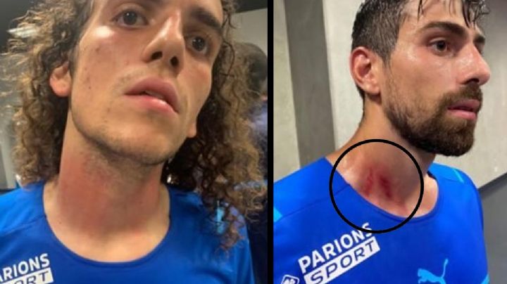 VIDEO: Aficionados invaden campo de juego y agreden futbolistas en Francia