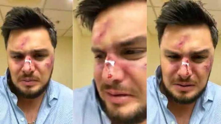 VIDEO: Paul Stanley preocupa a fans al aparecer golpeado en la cara; ¿qué le pasó?