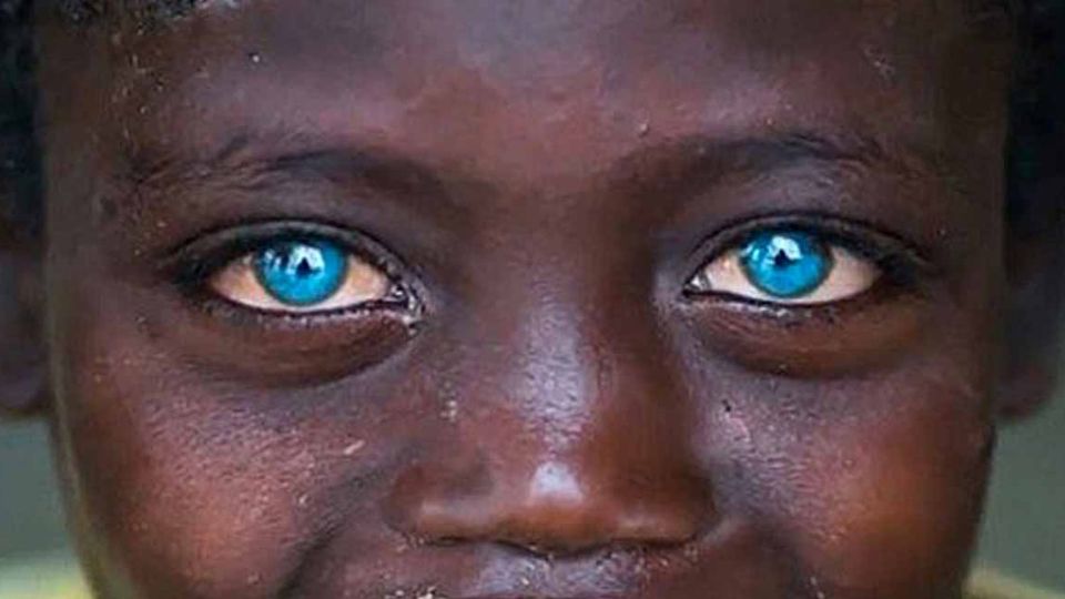 Por sus ojos azules ha sido discriminado en su comunidad