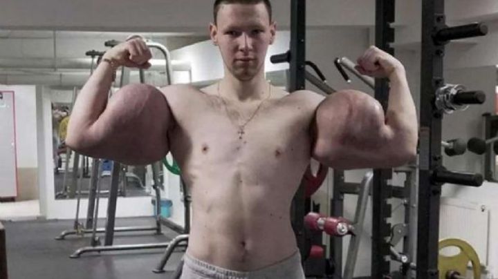 VIDEO: Biceps del Popeye ruso 'explotan' en plena competencia de lucha