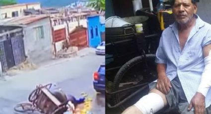 VIRAL: Elotero se cae con carrito y sufre quemaduras; usuarios buscan apoyarlo