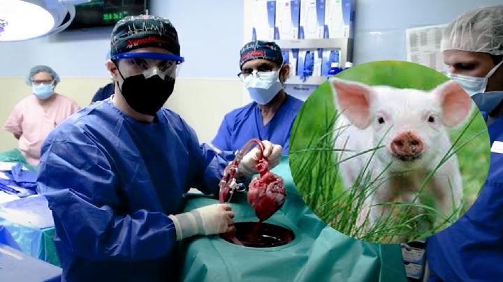 ¡Insólito! Se realiza con éxito el primer transplante de corazón de un cerdo a un humano. VIDEO