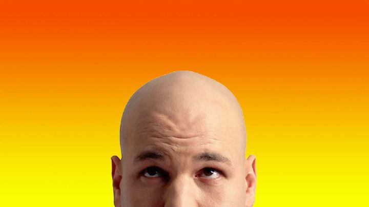 Calvos dominarían el mundo: son más sabios, fuertes y atractivos