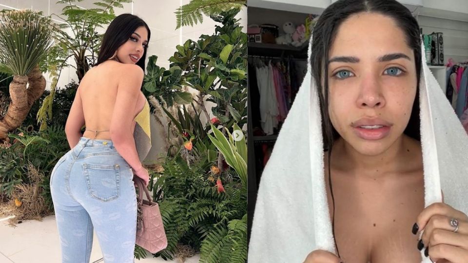 La influencer Yeri Mua, también conocida como la Bratz Jarocha, sufrió un accidente en