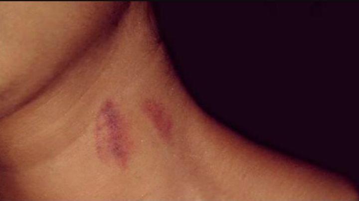 Tamaulipeco da golpiza a su esposa por “llegar con chupetones” a su casa