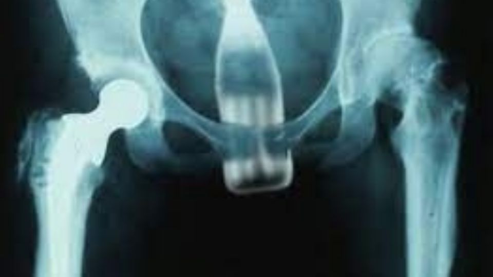 Los médicos encuentran cada cosa en urgencias (imagen ilustrativa)