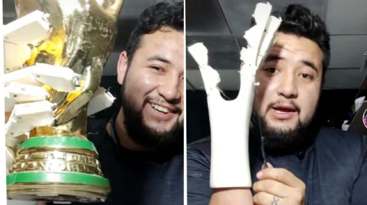 Fabrica su propia prótesis de madera y da esperanza a quienes no tienen los medios para obtener una