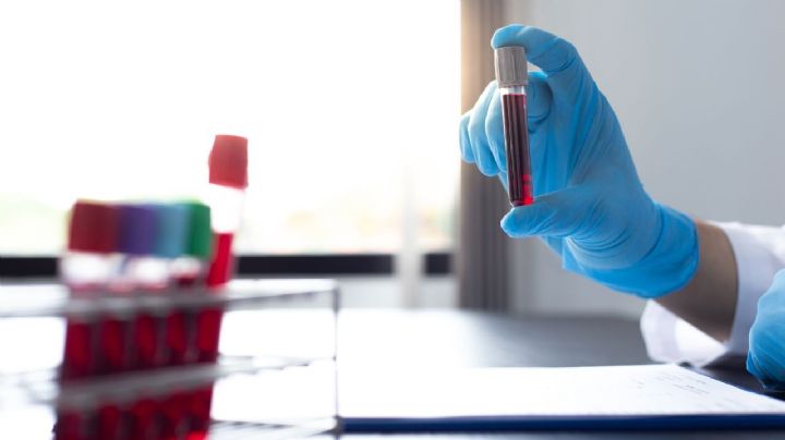 Japón autoriza comercialización de prueba casera para detectar Alzheimer