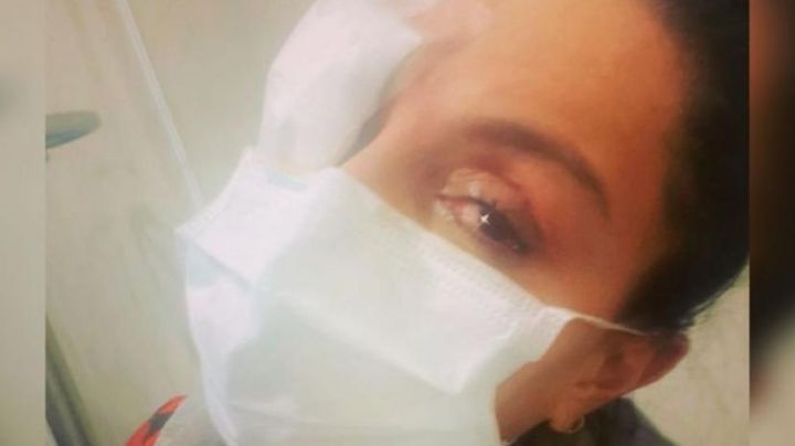 Ivonne Montero se quema las córneas por accidente: " ya no tenía visión"