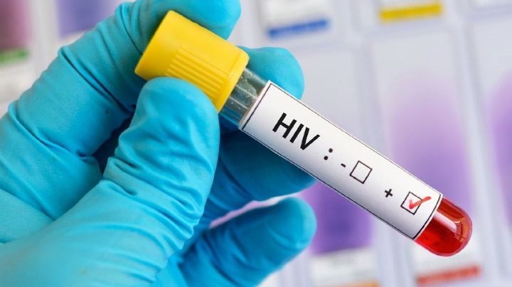 Ingresan 12 nuevos casos de VIH en 2022