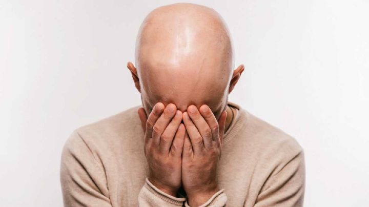 Llamar pelón a un hombre será considerado acoso íntimo