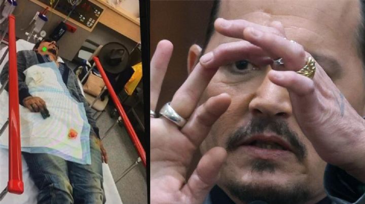 ¿Deep también miente? Cirujano desmiente su versión sobre fractura ante pelea con Amber VIDEOS