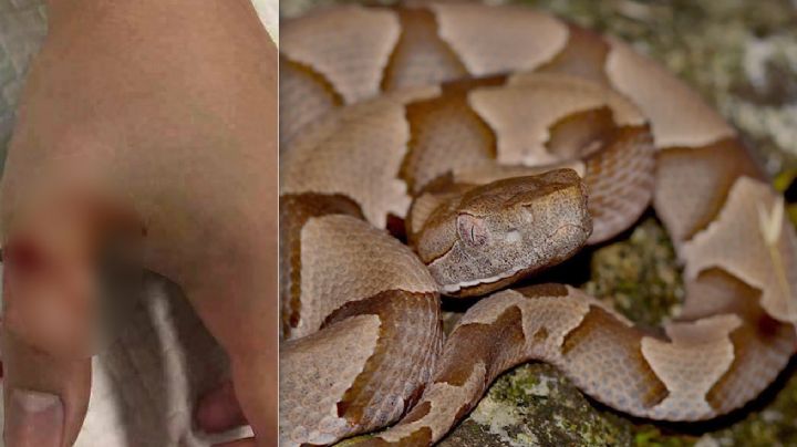 Serpiente ‘copperhead’ muerde niño de cinco años en Texas