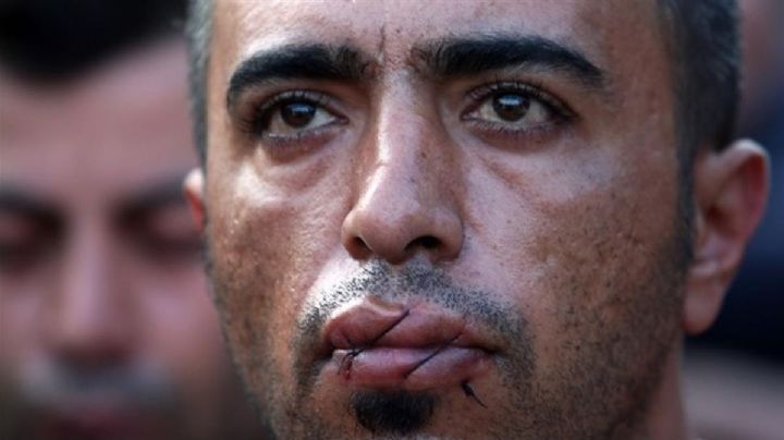 VIDEO: ¡Arman la protesta! Migrantes se cosen la boca ante falta de apoyo para cruzar la frontera