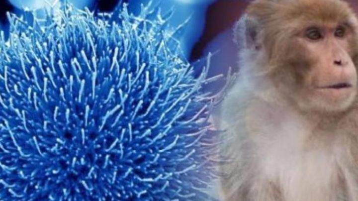 OMS modificará nombramiento de la Viruela del Mono por contribuir a la discriminación