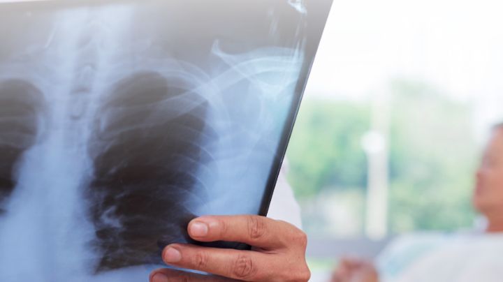 Mueren dos niños por neumonía en Nuevo Laredo