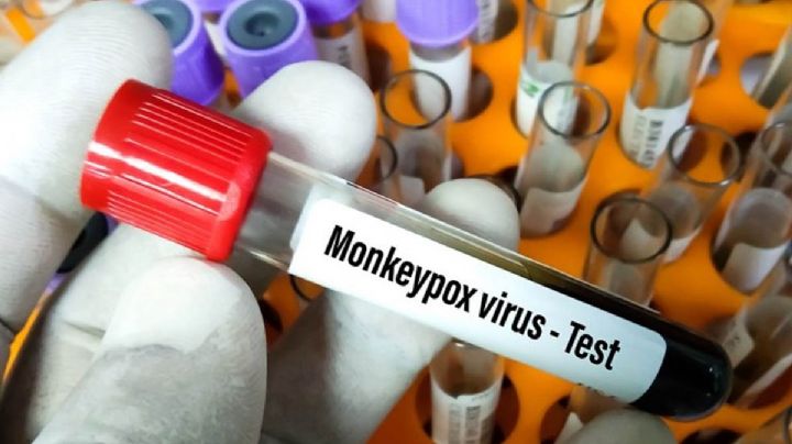 Reporta Perú primera muerte por viruela del mono