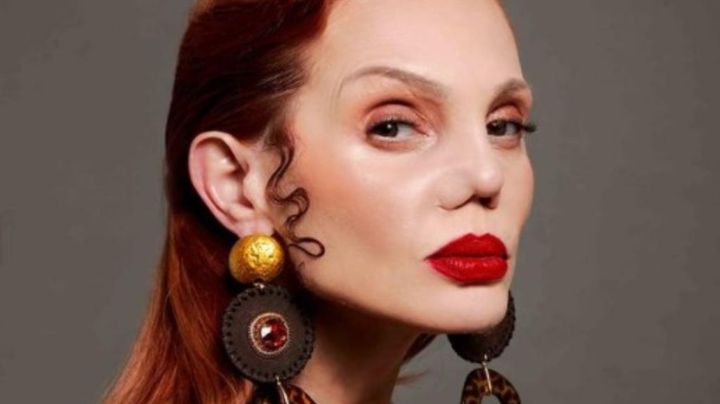 ¿Qué le pasó a Carmen Campuzano en la nariz? No fue cirugía, es una enfermedad