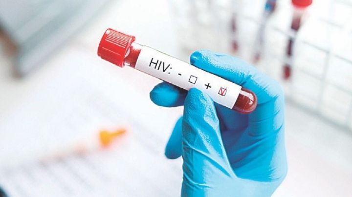 Surgen 25 nuevos enfermos de VIH