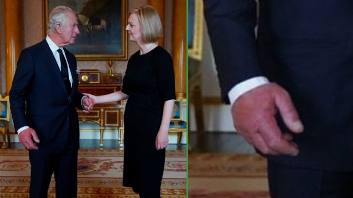 Preocupa la salud del Rey Carlos III por sus "dedos de salchicha"