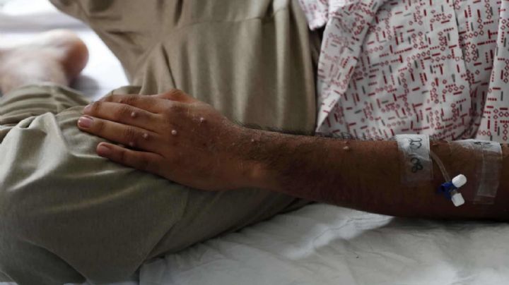 China pide a sus ciudadanos evitar contacto con extranjeros ante viruela del mono