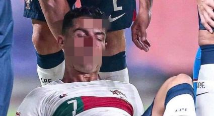 Portero le destroza la cara a Cristiano Ronaldo al chocar de frente | VIDEO