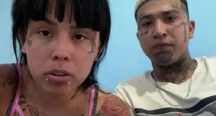 Mona sigue los pasos de Karely Ruiz; se pone implantes y así luce ahora | FOTO