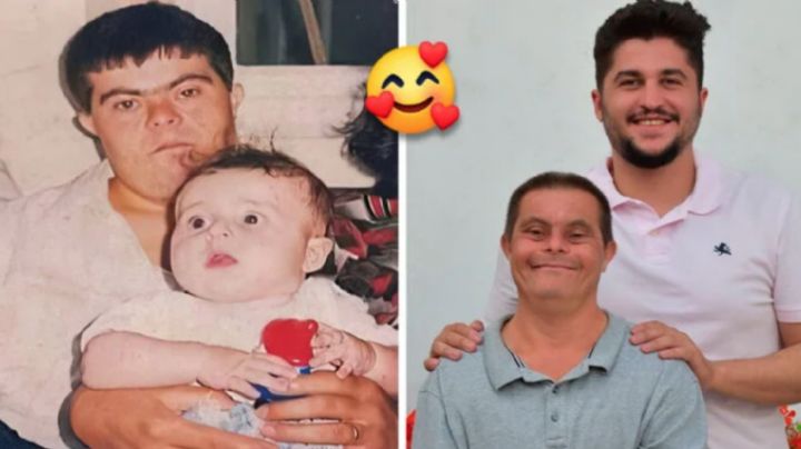Papá con síndrome de Down logró sacar adelante a su hijo y ahora es un exitoso doctor