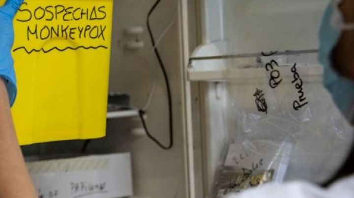 América se ha convertido en el epicentro de la Viruela del Mono