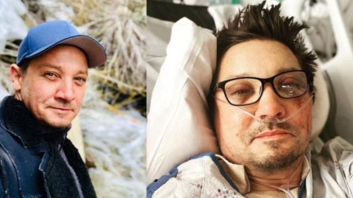 Actor de Hawkeye revela que se rompió más de 30 huesos en su accidente