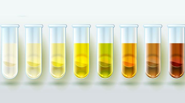 Color de la orina te indica si tienes un alto riesgo de salud sin saberlo