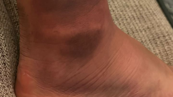 Jugador de Rayados sufre tremendo golpe en el tobillo; es su 'pata de elefante'