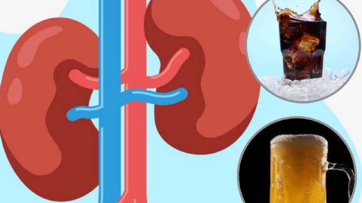 ¿Qué bebida daña más a tus riñones, el refresco o la cerveza?