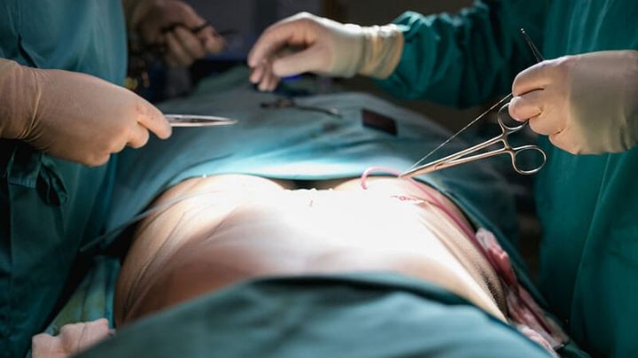 Muere mujer durante cirugía estética; se durmió y ya no despertó