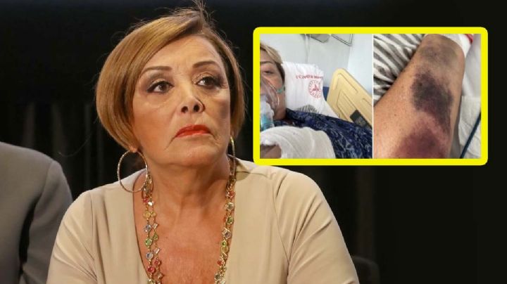 Reportan que Sylvia Pasquel sufrió una trombosis: fue hospitalizada de emergencia