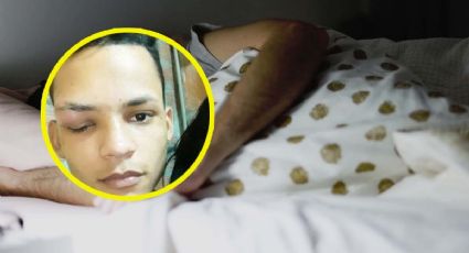 Joven dormía con mascota y termina con un gusano en el ojo | VIDEO