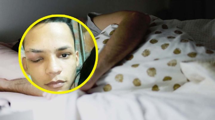 Joven dormía con mascota y termina con un gusano en el ojo | VIDEO