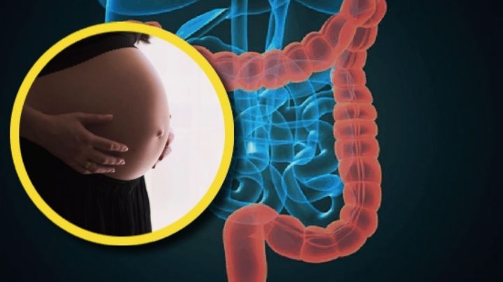 "Tiene un bebé en el intestino": va al médico por un dolor de estómago y le dan impactante noticia